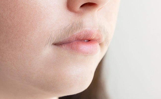 चेहरे के छोटे-छोटे बालों को हटाने के लिए अपनाकर देखें ये 5 नेचुरल तरीके
